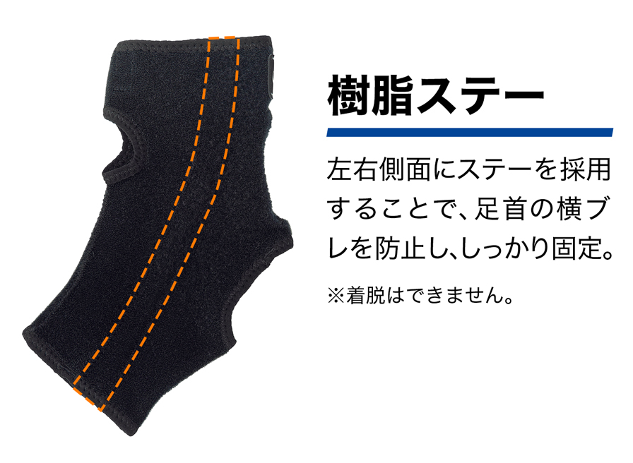 樹脂ステー